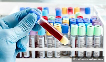 Kan Tahlillerindeki Kısaltmaların Anlamı Ne?