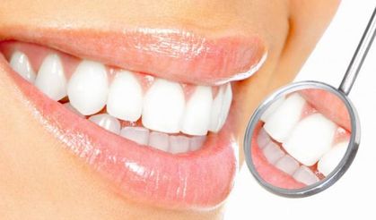 Diş beyazlatma kalıcı çözüm değil