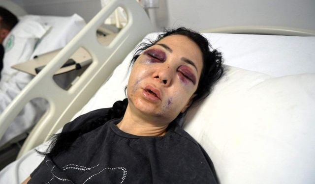 Şiddetle Mücadele Eder-miş Gibi Yapmanın Sonucu!