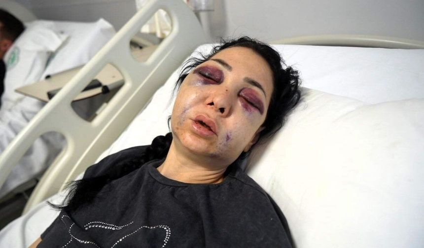 Şiddetle Mücadele Eder-miş Gibi Yapmanın Sonucu!